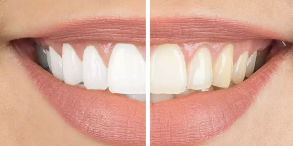 Close up shot of a woman's mouth which is split into two sections, each of which are both in white and dull.